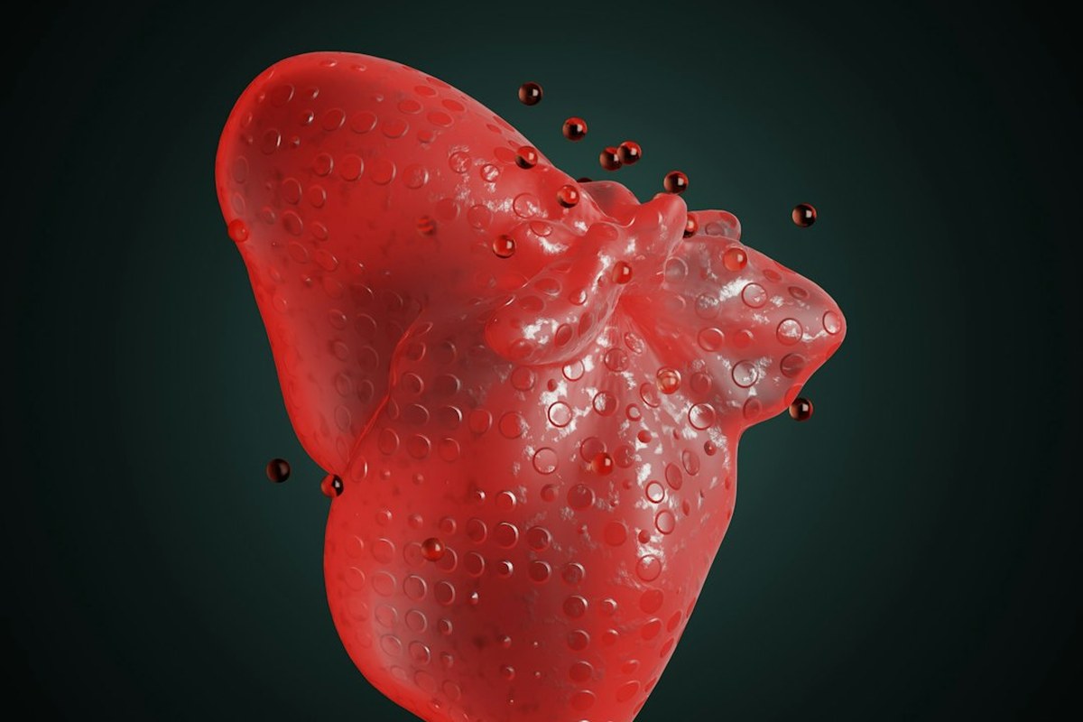 간암 치료 ‘큰 발전’ 이뤘지만 생존 열쇠는 ‘조기 발견’ - 이미지 1