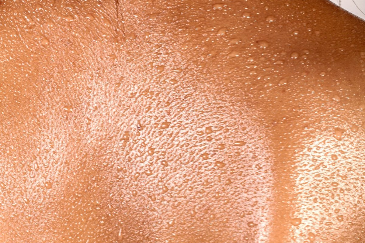 피부에 ‘이 증상’ 나타나더니, 5개월 뒤 사망… 40대 女 무슨 일? - 이미지 3