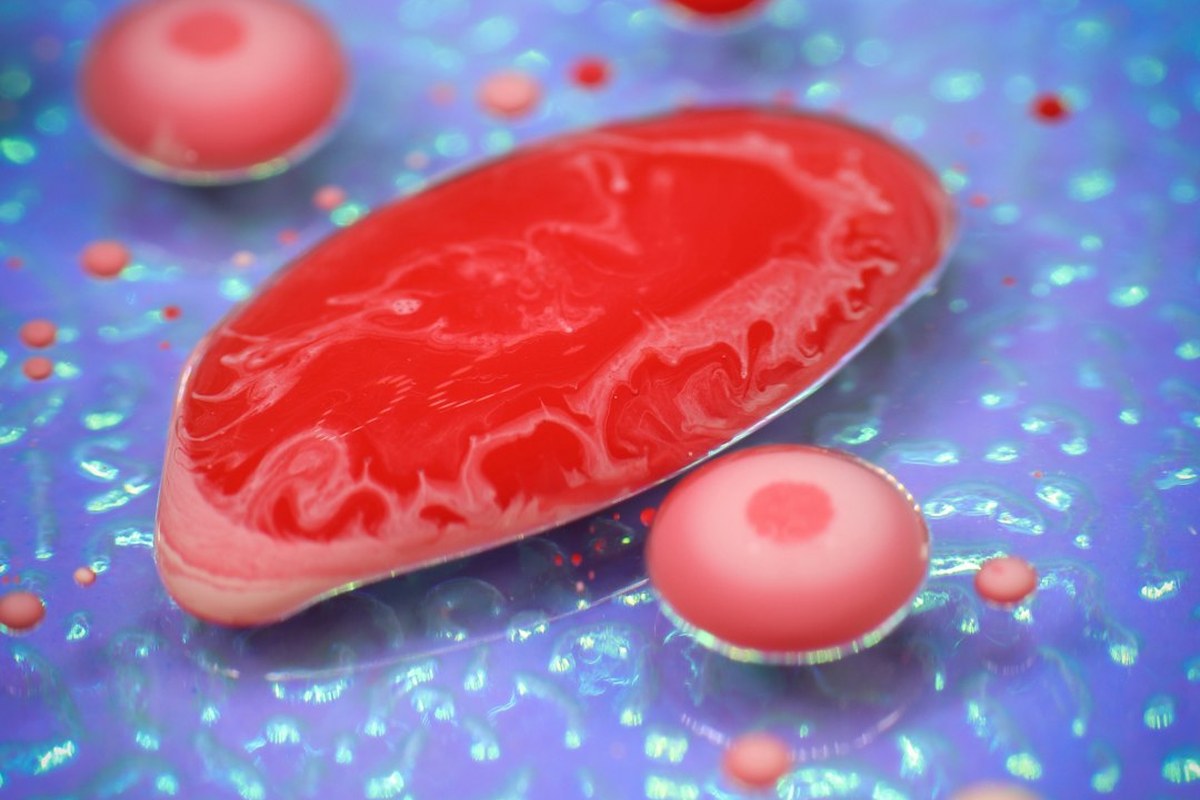간암 치료 ‘큰 발전’ 이뤘지만 생존 열쇠는 ‘조기 발견’ - 이미지 4