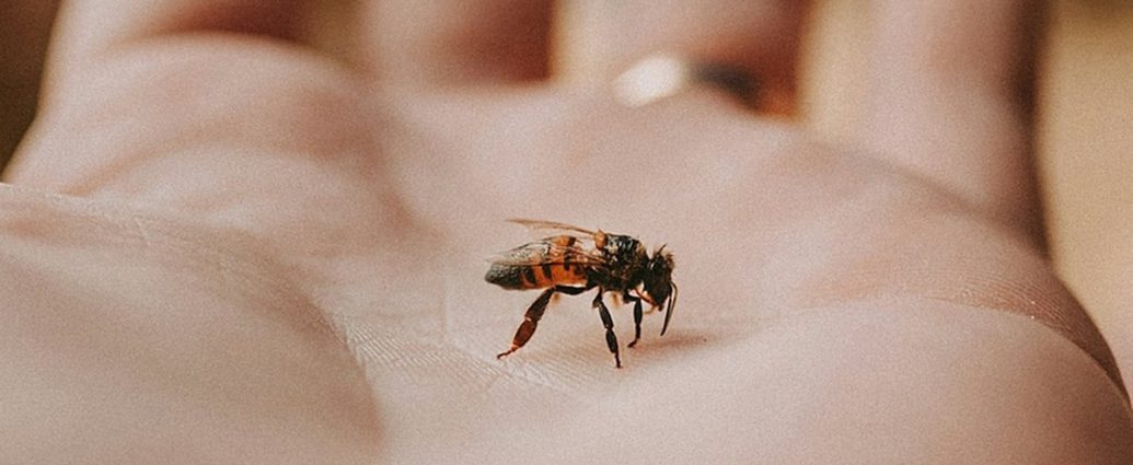 ⚠️ 말벌 쏘임, 생명 위협하는 아나필락시스 쇼크! 증상과 응급처치법 💡
