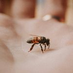 ⚠️ 말벌 쏘임, 생명 위협하는 아나필락시스 쇼크! 증상과 응급처치법 💡