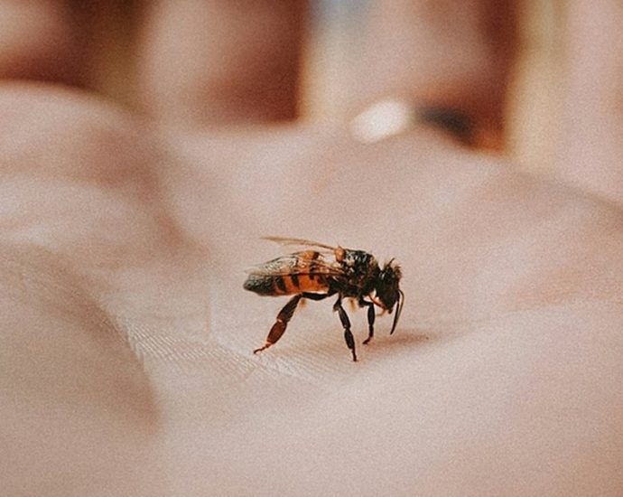 ⚠️ 말벌 쏘임, 생명 위협하는 아나필락시스 쇼크! 증상과 응급처치법 💡
