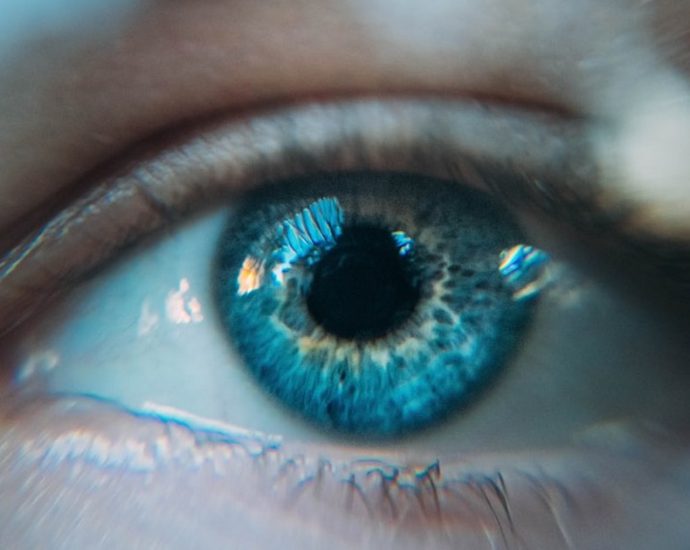 나이 들어 눈꺼풀 처지니 눈 이물감 커지네··· 원인은 ‘속눈썹’이 각막에 낸 상처