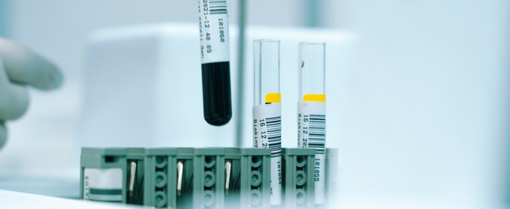 “심혈관계 질환 의심되면 받아보세요”⋯검진 센터에서 이달 초까지 무료라는 ‘이 검사’는 무