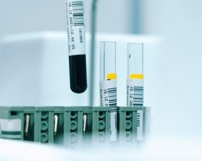 “심혈관계 질환 의심되면 받아보세요”⋯검진 센터에서 이달 초까지 무료라는 ‘이 검사’는 무