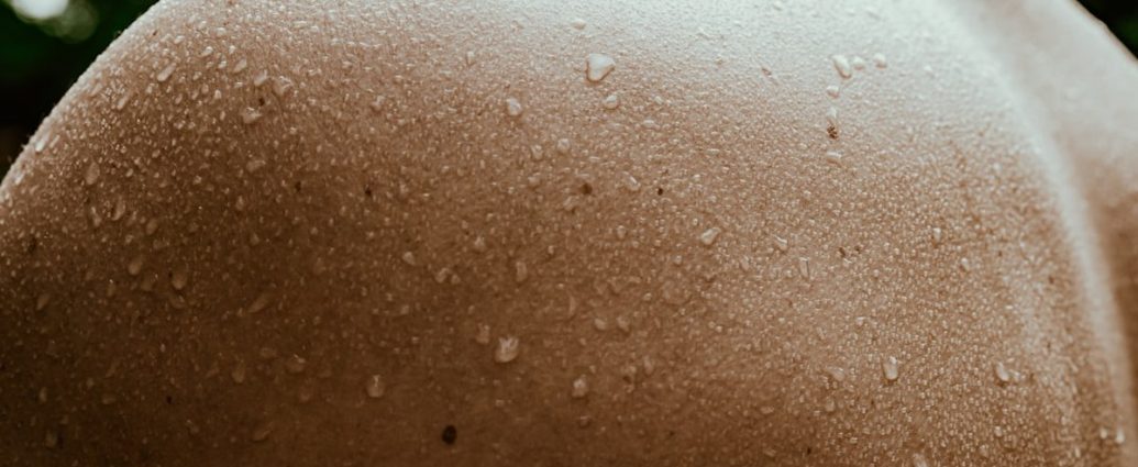 벌써 겁나는 다한증…수술만이 답일까? [건강한겨레]