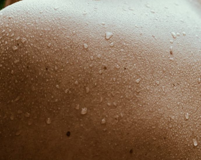 벌써 겁나는 다한증…수술만이 답일까? [건강한겨레]