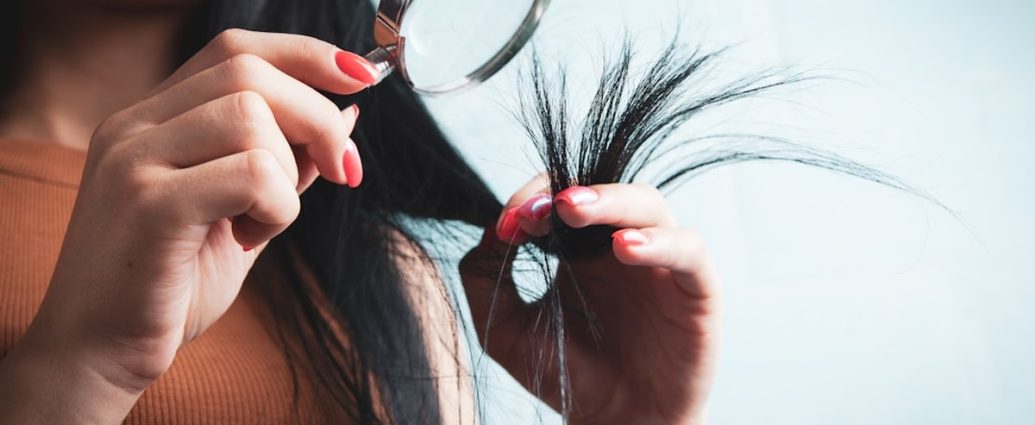 탈모 치료제 장기 복용해도 문제없을까? [건강한겨레]