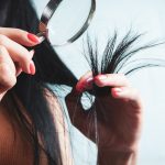 탈모 치료제 장기 복용해도 문제없을까? [건강한겨레]