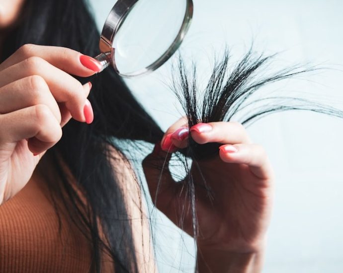 탈모 치료제 장기 복용해도 문제없을까? [건강한겨레]