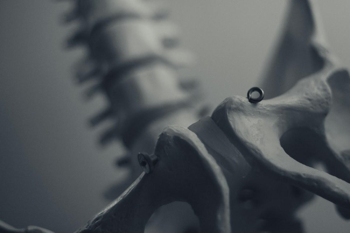 꼬리뼈 통증, 오래간다면? 생활 습관부터 점검하세요! 💡✅ - 이미지 1