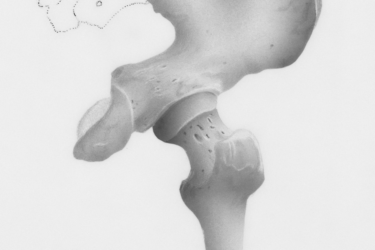 🏃‍♀️ 요즘 인기 운동, 고관절에 '이런' 부담 준다고? ⚠️ 조심하세요! - 이미지 1