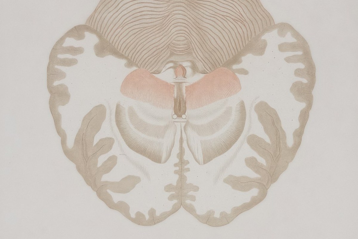 뇌종양 방사선 치료, 시력 보호 위해 줄였더니… 10년 뒤 시력 저하 위험 ↑ ✅ - 이미지 2