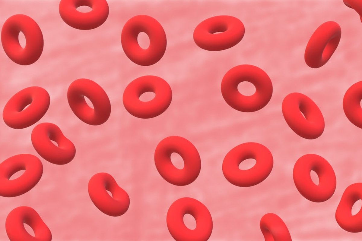 🚨 빈혈, 단순 피로 NO! 치매 위험 66% UP! 뇌 건강 적신호 💡 - 이미지 2