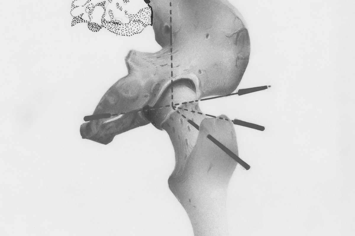 🏃‍♀️ 요즘 인기 운동, 고관절에 '이런' 부담 준다고? ⚠️ 조심하세요! - 이미지 2