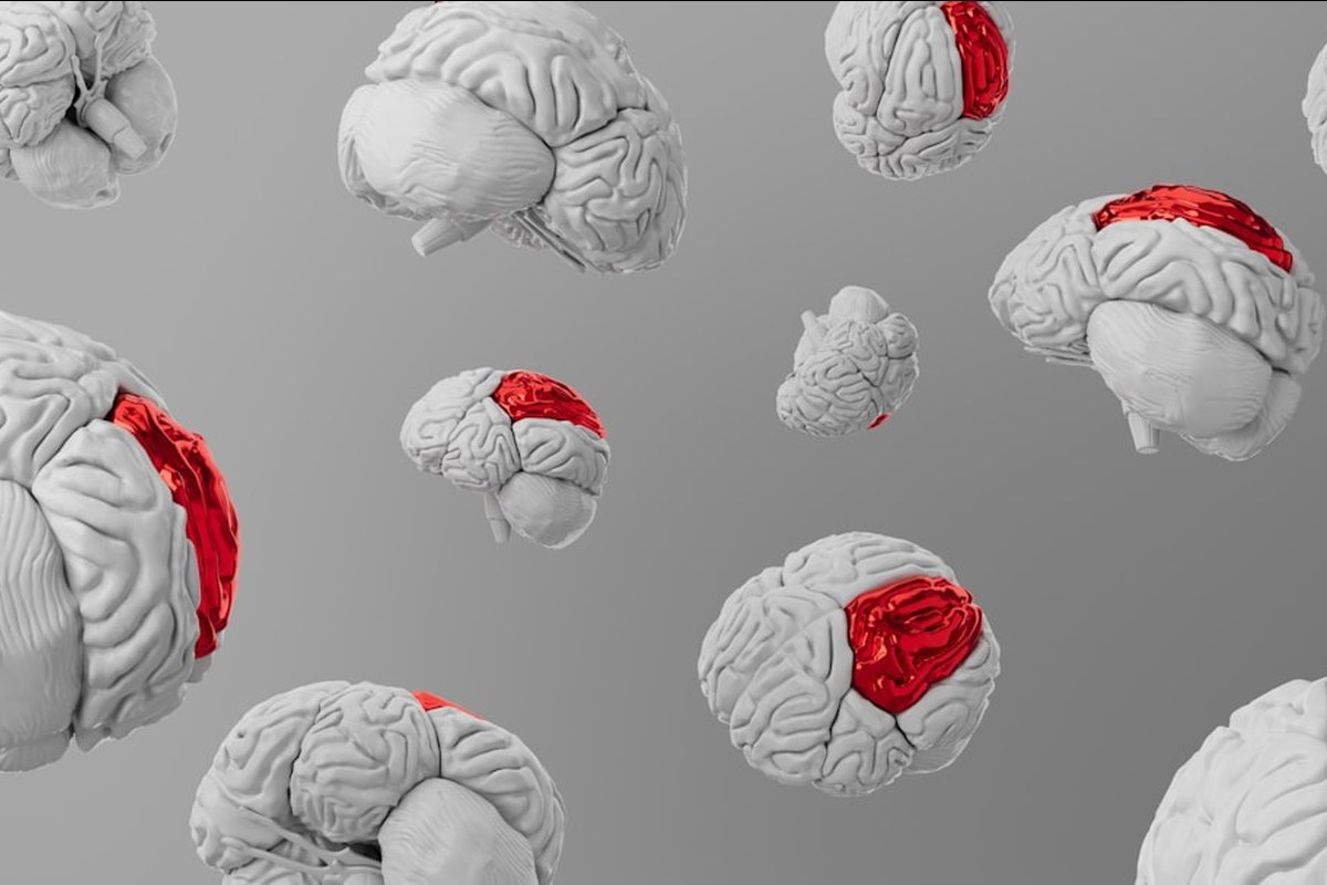 뇌출혈 응급상황, 강인 덕분에 산 이진호! 🚨 생명 구한 골든타임과 뇌출혈 예방법 ✅ - 이미지 3