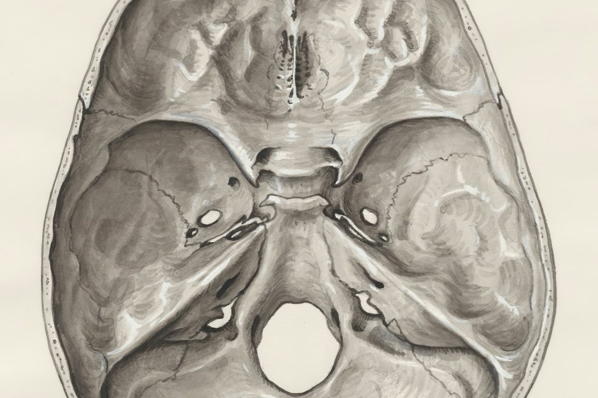 💡 뇌척수액 없이 치매 조기 진단? '미니 뇌'가 열어갈 미래! - 이미지 3