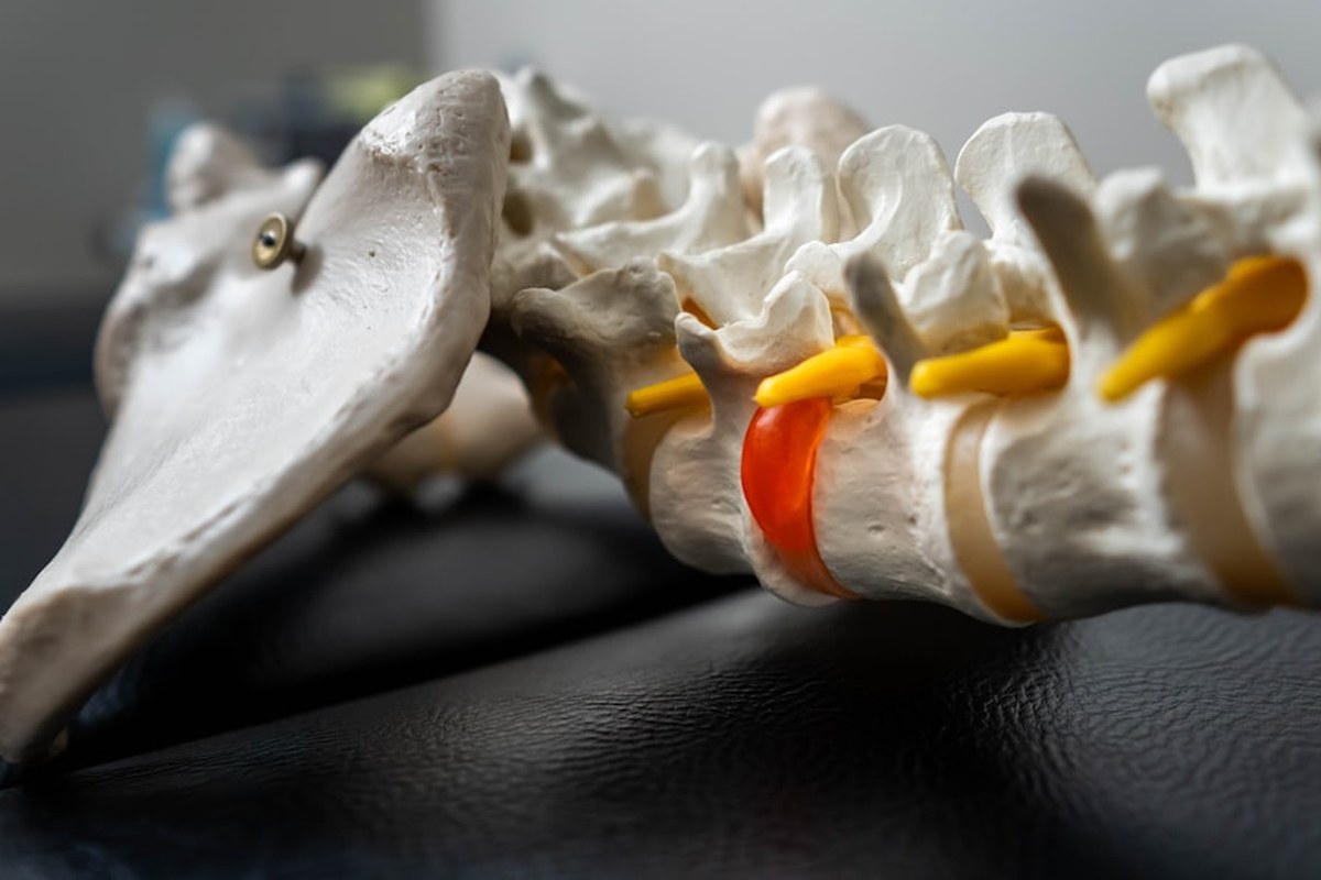 튼튼한 허리, 뱃살 고민 끝! 기립근 강화로 통증 잡는 비법 ✅ - 이미지 3