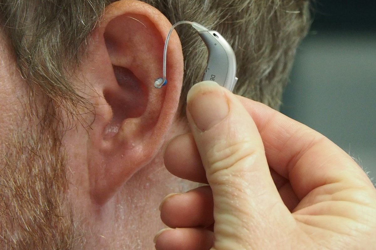 삐 소리 이명, 첫 3개월이 치료 골든타임! 💡 서울성모병원 연구 결과 - 이미지 3