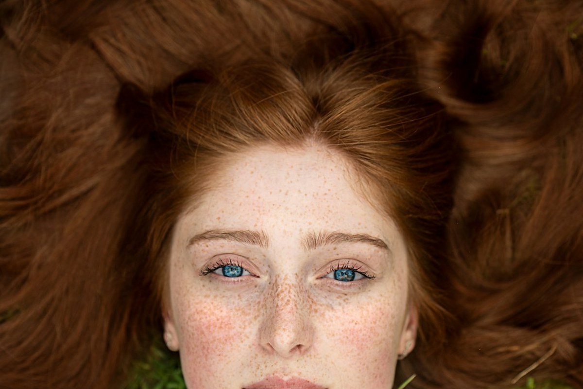 붉어진 얼굴, 단순 열감? '안면 홍조' 방치하면 위험! 💡 원인부터 관리법까지 총정리 ✅ - 이미지 3