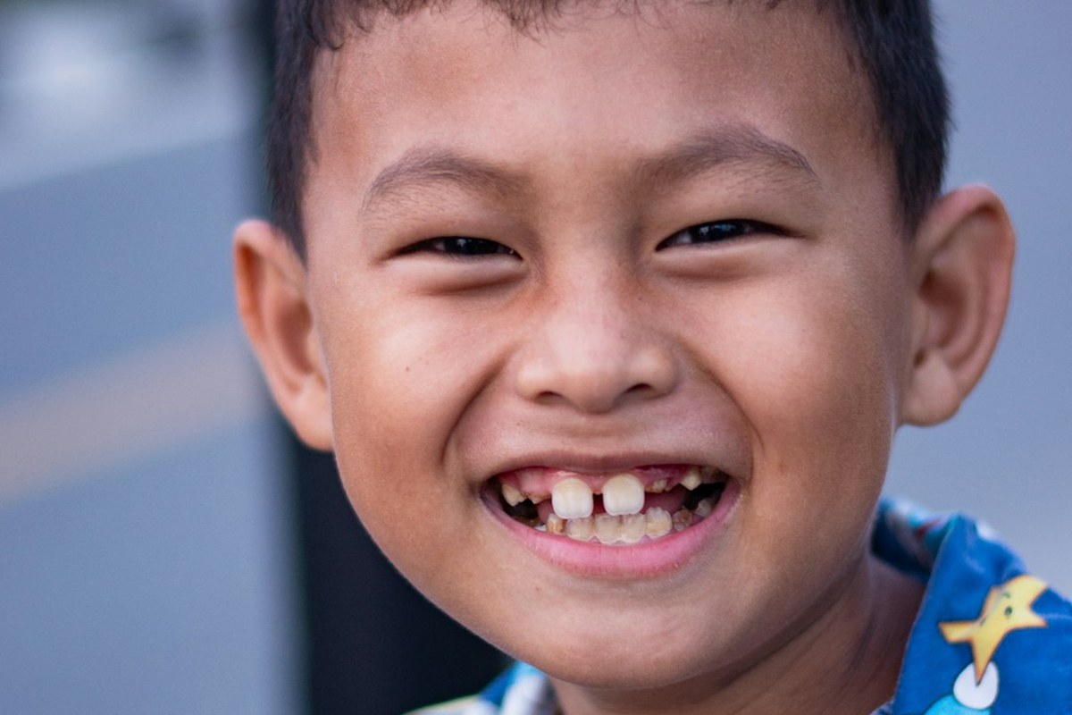 ✅ 성장기 치아교정, '언제'가 가장 중요할까? 🦷 적절한 시점 가이드 - 이미지 3