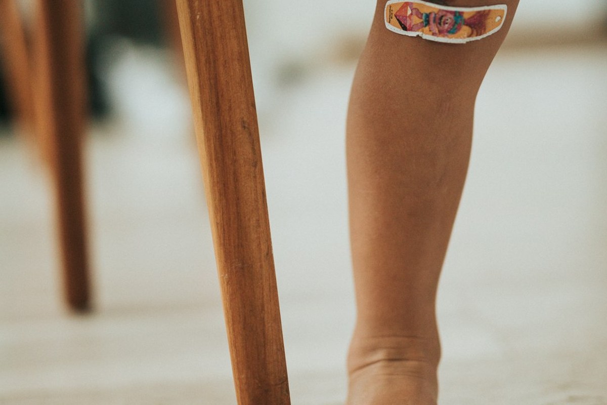 💥무릎 골절, 단순 뼈 부상? 관절 기능 지키는 초기 치료의 모든 것! ✅ - 이미지 4