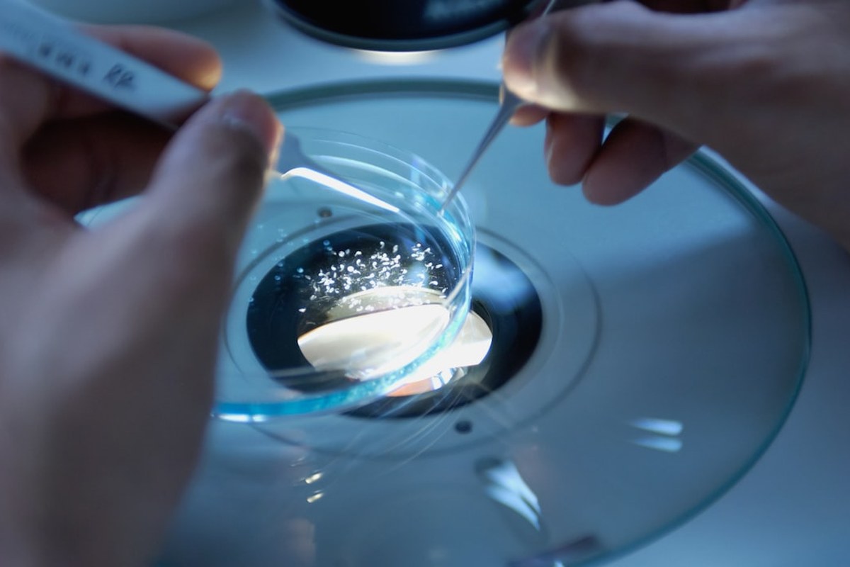 🦠 박쥐 유래 알파코로나바이러스, 인간 세포 침투 경로 발견! CEACAM6 수용체로 침투 가능성 확인 💡 - 이미지 4