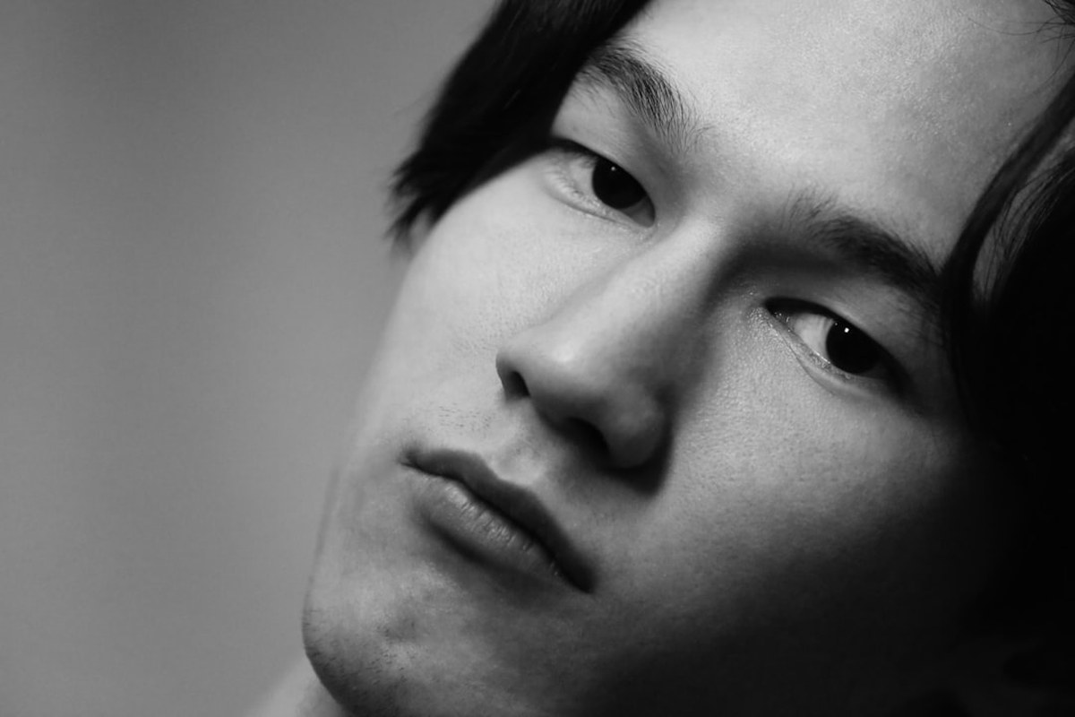 주걱턱교정, 단순 배열?... 교합과 얼굴 균형까지 고려해야 - 이미지 4