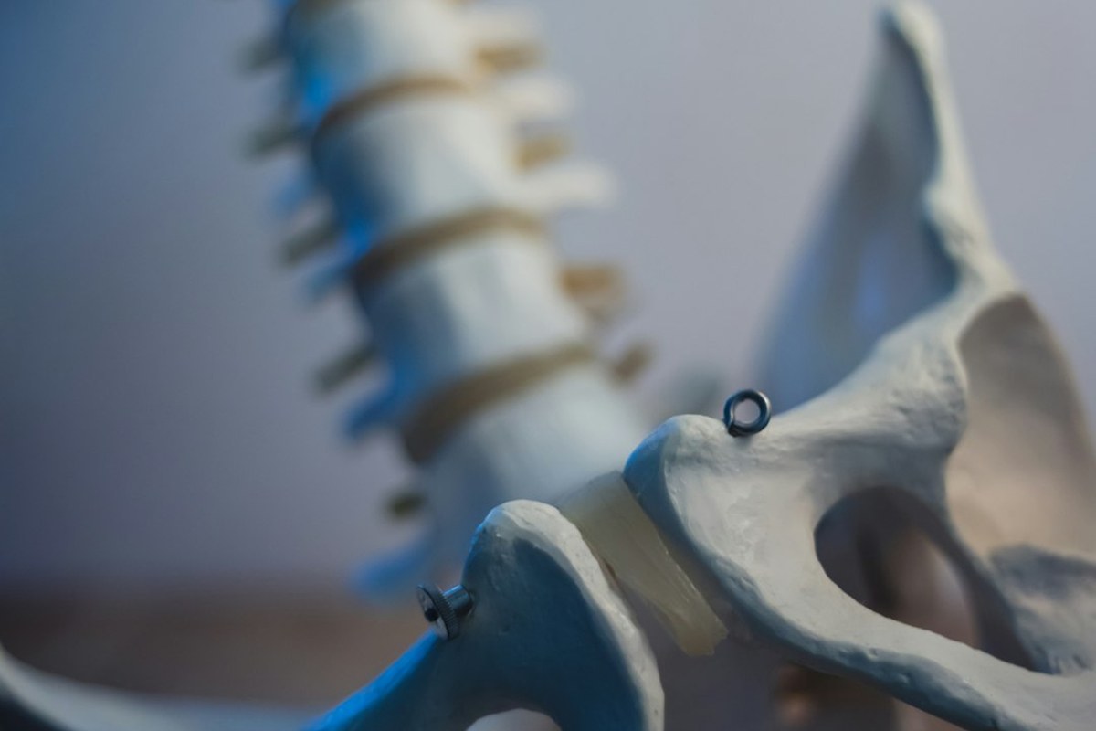 꼬리뼈 통증, 오래간다면? 생활 습관부터 점검하세요! 💡✅ - 이미지 4