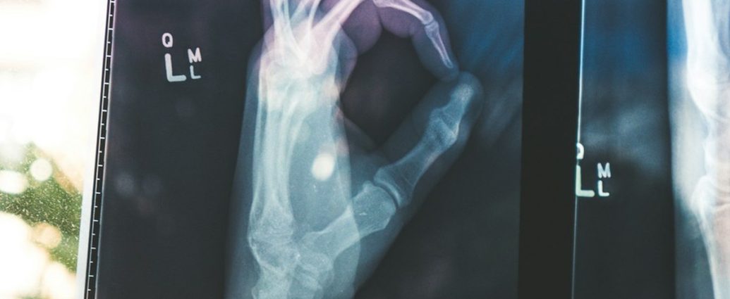 ✅ 뼈 건강 UP! 우유보다 칼슘 풍부한 7가지 슈퍼푸드 공개 💡