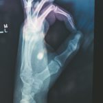 ✅ 뼈 건강 UP! 우유보다 칼슘 풍부한 7가지 슈퍼푸드 공개 💡