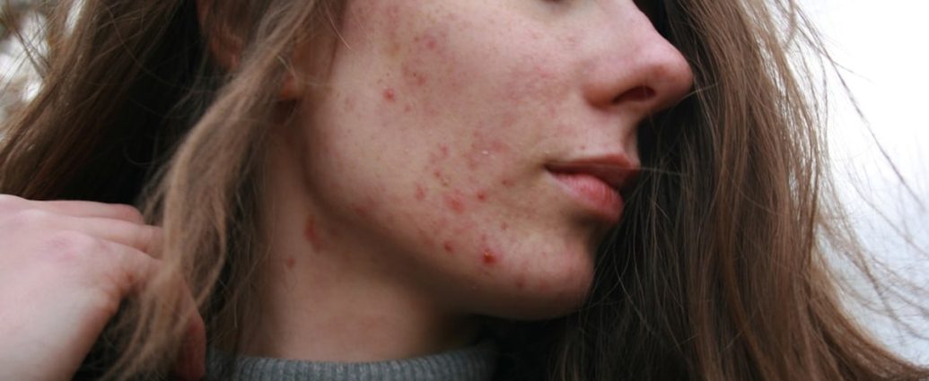 “나만의 동안 비법 있다”… 강예원이 밝힌 ‘저속노화’ 루틴은?