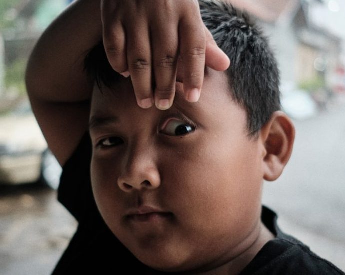 "눈에서 빛이 나요!"… 우리 아이, 안구암 망막모세포종 조기 발견의 중요성 ✅