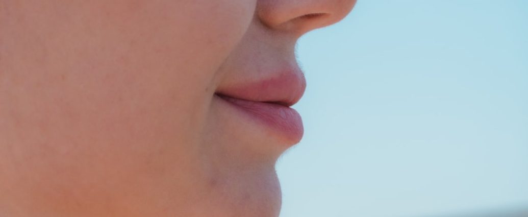 주걱턱교정, 단순 배열?... 교합과 얼굴 균형까지 고려해야