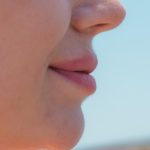 주걱턱교정, 단순 배열?... 교합과 얼굴 균형까지 고려해야