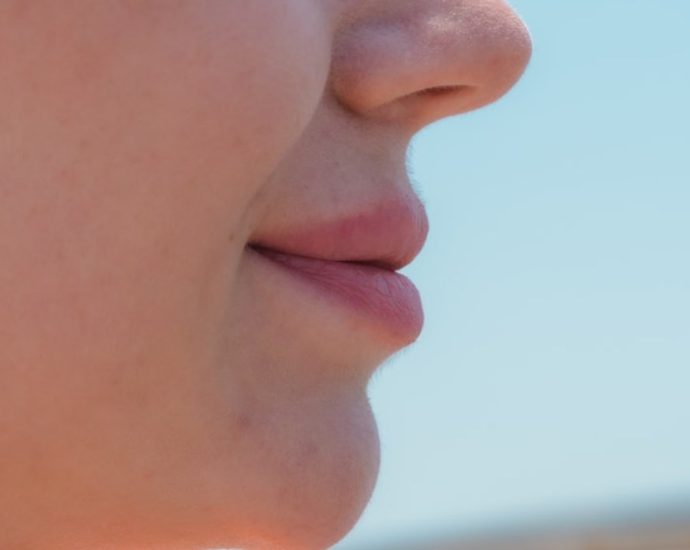 주걱턱교정, 단순 배열?... 교합과 얼굴 균형까지 고려해야