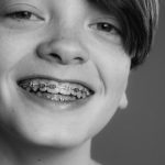 ✅ 성장기 치아교정, '언제'가 가장 중요할까? 🦷 적절한 시점 가이드