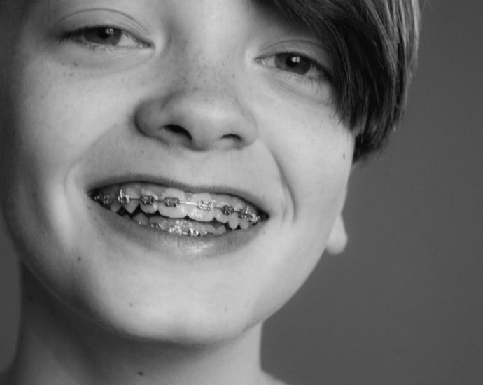 ✅ 성장기 치아교정, '언제'가 가장 중요할까? 🦷 적절한 시점 가이드