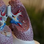 🚭️흡연자 95%가 걸리는 '소세포폐암', 치명적인 이유와 조기 발견 팁 ✅