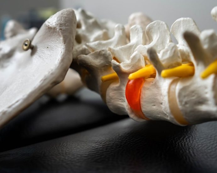 꼬리뼈 통증, 오래간다면? 생활 습관부터 점검하세요! 💡✅