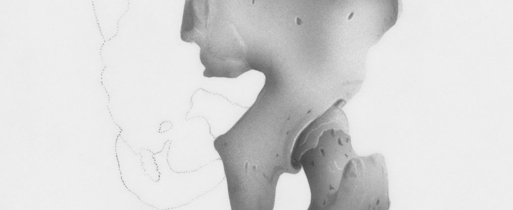 🏃‍♀️ 요즘 인기 운동, 고관절에 '이런' 부담 준다고? ⚠️ 조심하세요!