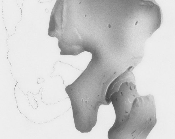 🏃‍♀️ 요즘 인기 운동, 고관절에 '이런' 부담 준다고? ⚠️ 조심하세요!