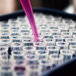 10년 난치 자가면역질환, 3주 만에 잡은 혁신 CAR-T 치료법! ✅