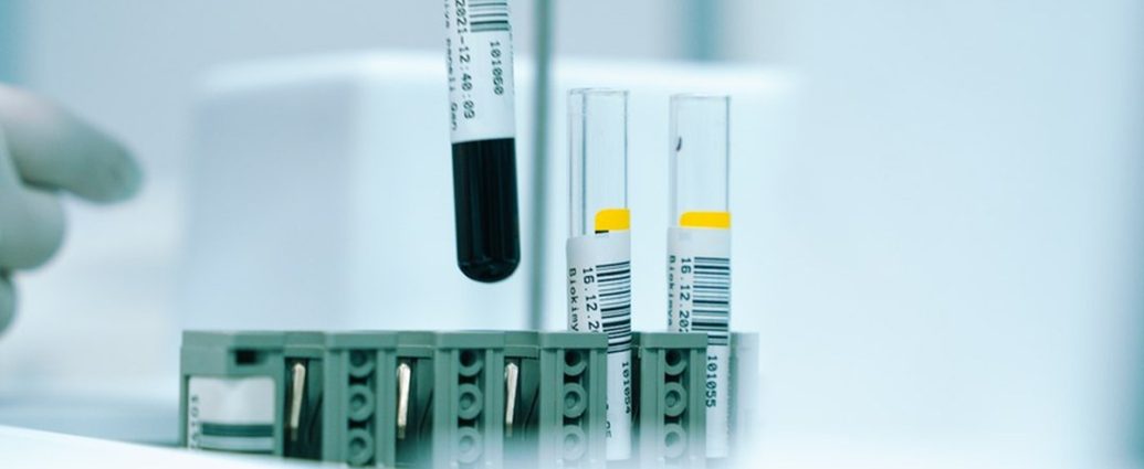 HDL 콜레스테롤 높으면 무조건 좋을까? 당뇨·콩팥 있다면 확인할 것
