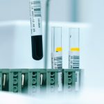HDL 콜레스테롤 높으면 무조건 좋을까? 당뇨·콩팥 있다면 확인할 것
