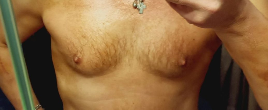 남성 유방암 증상, 유두 옆 멍울이 만져졌다면 이렇게 하세요
